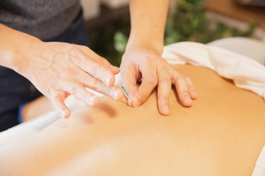 How to Get Financing for an Acupuncturist Company